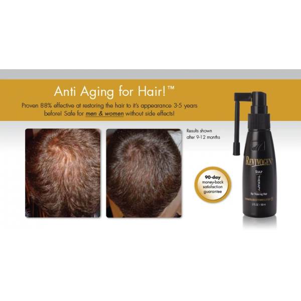 Revivogen MD Scalp Therapy for Thinning Hair