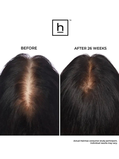 HairMax LaserBand 82 ComfortFlex