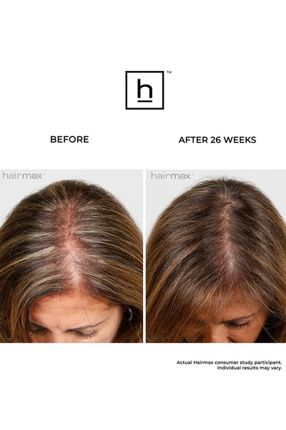 HairMax ULTIMA 9 LaserKam