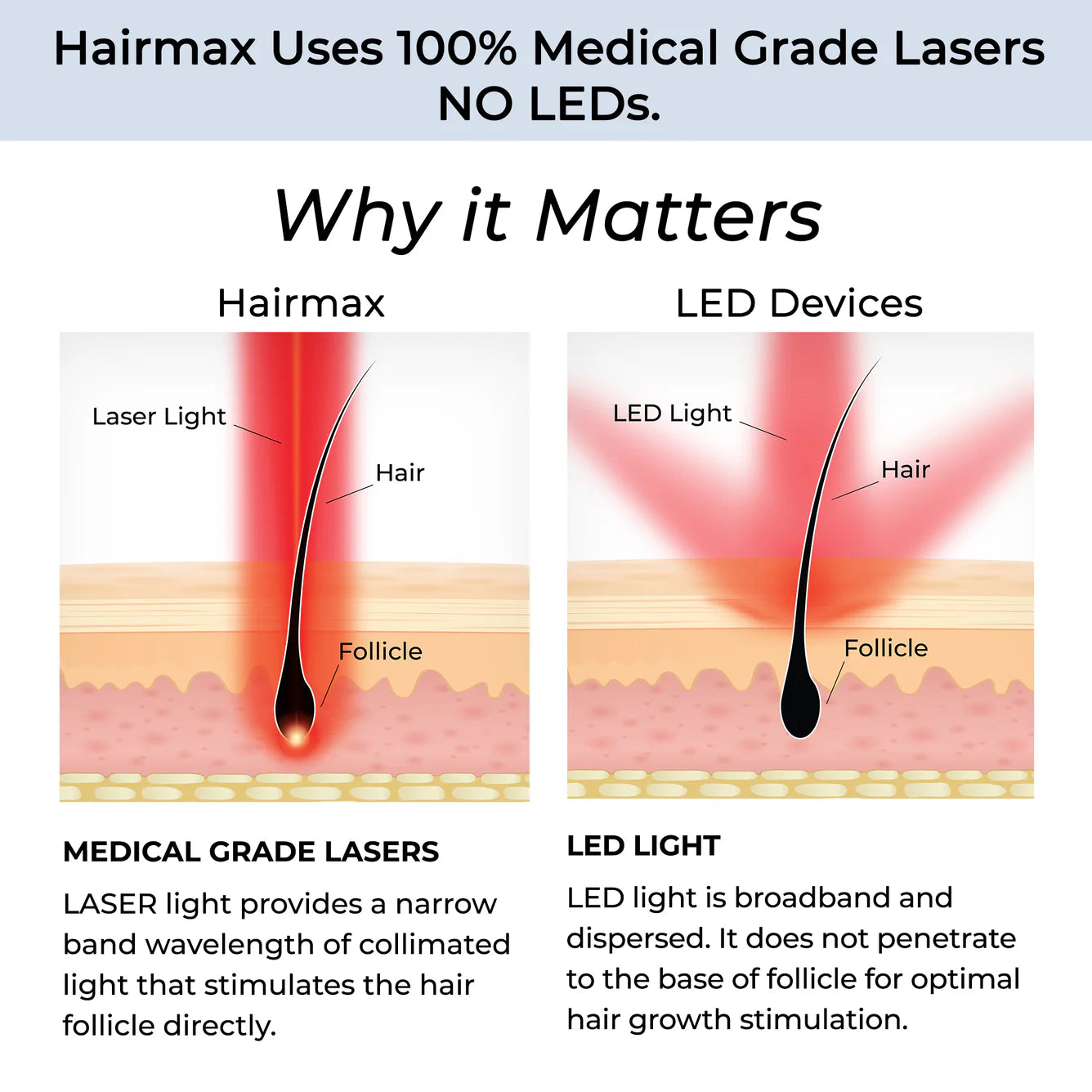 Hairmax LaserBand 41 Comfort Flex