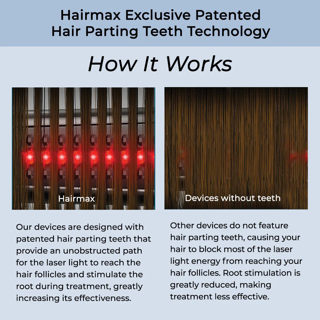 HairMax LaserBand 82 ComfortFlex