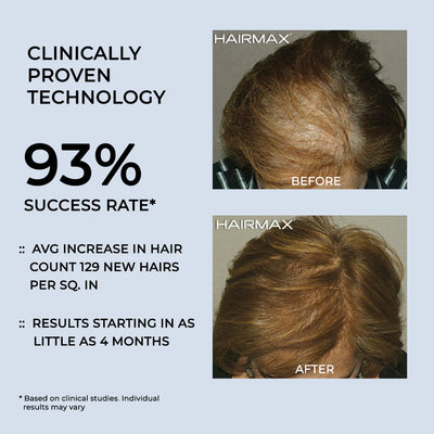 HairMax ULTIMA 9 LaserKam