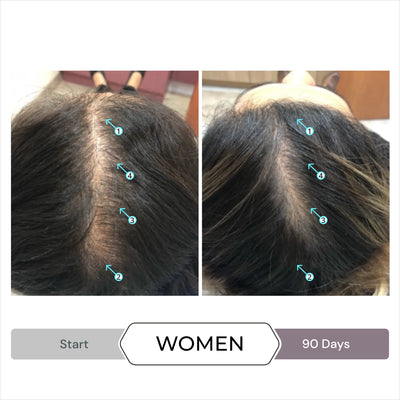 Spectral.CSF Women's Targeted Therapy for Thinning Hair 60 ml
