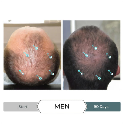 Spectral.F7 Anti-Hair Loss Efficacy Booster met Astressin - B